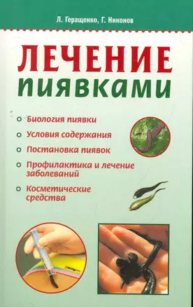 Лечение пиявками — 2270979 — 1