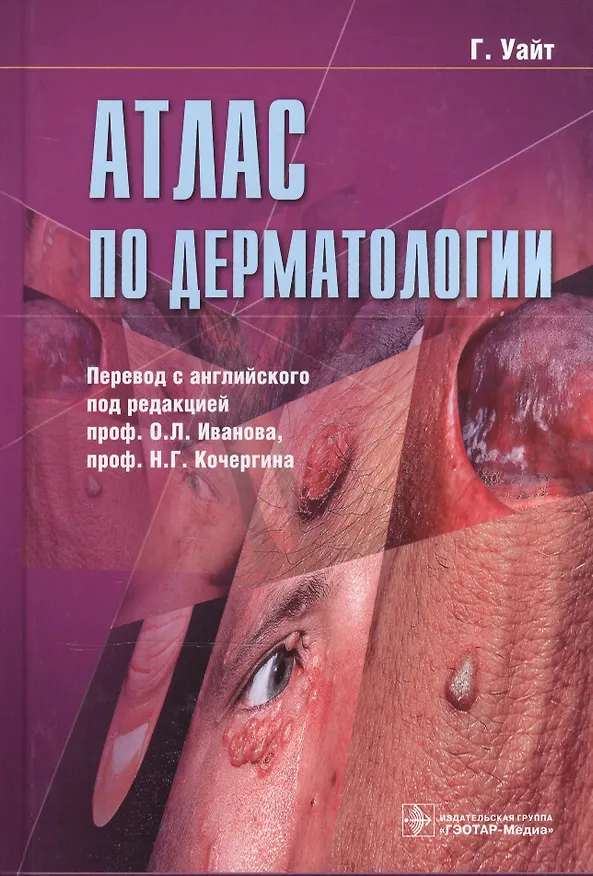 Книга Атлас по дерматологии (Гарри Уайт) — 1