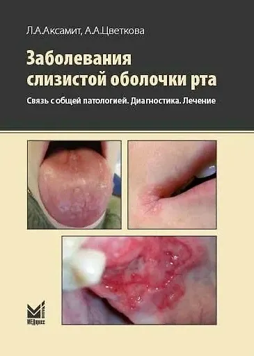 Книга Заболевания слизистой оболочки рта. Связь с общей патологией. Диагностика. Лечение (Александра Цветкова, Людмила Аксамит) — 1