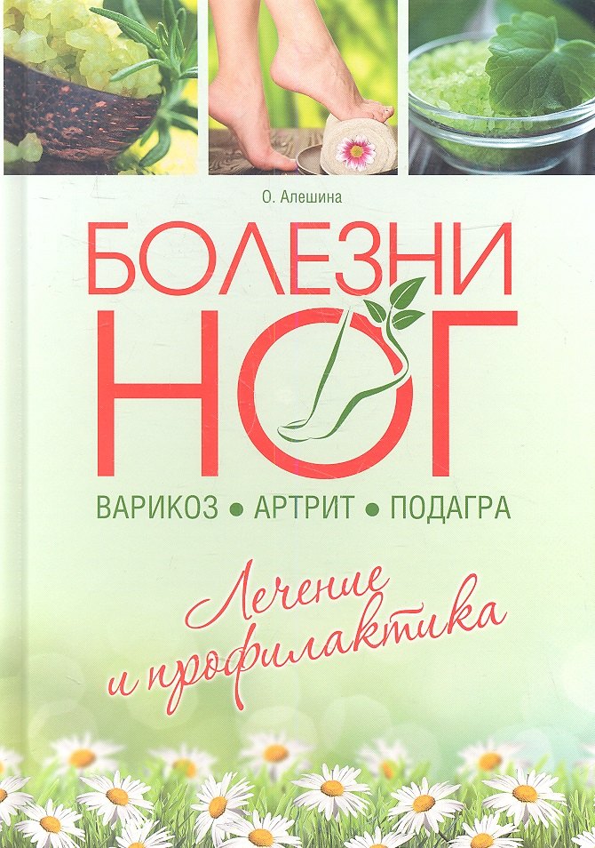

Болезни ног: варикоз артрит подагра
