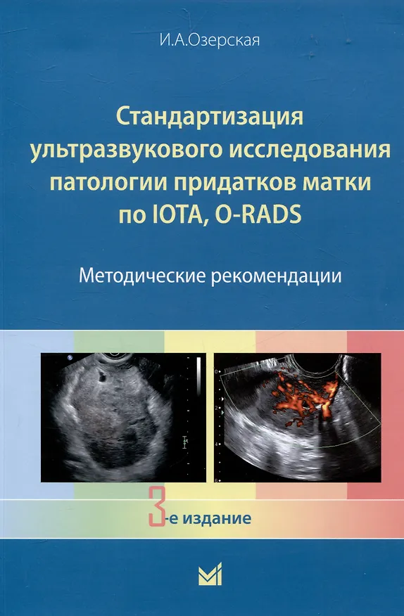 Книга Стандартизация ультразвукового исследования патологии придатков матки по IOTA, O-RADS. Методические рекомендации (Ирина Озерская) — 1