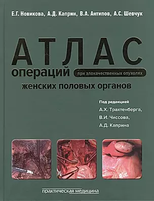 Атлас операций при злокачественных опухолях женских половых органов (Новикова) — 2522461 — 1