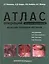 Атлас операций при злокачественных опухолях женских половых органов (Новикова) — 2522461 — 1