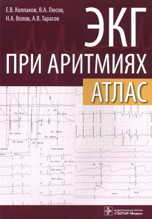 ЭКГ при аритмиях Атлас (+линейка электрокардиографическая) (м) Колпаков — 2512793 — 1