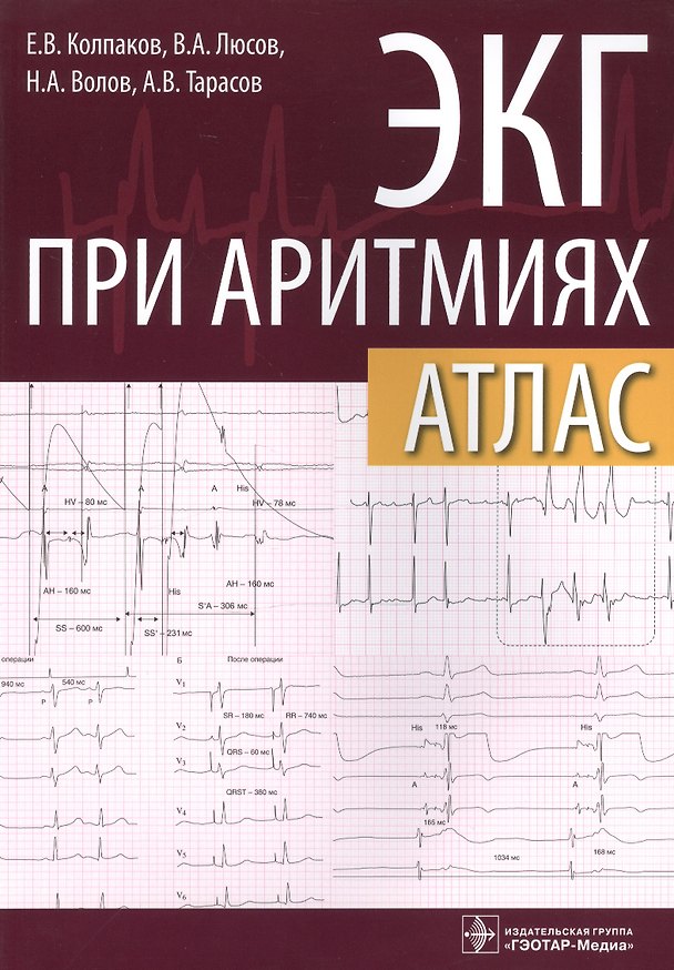 Книга ЭКГ при аритмиях Атлас (+линейка электрокардиографическая) (м) Колпаков () — 1