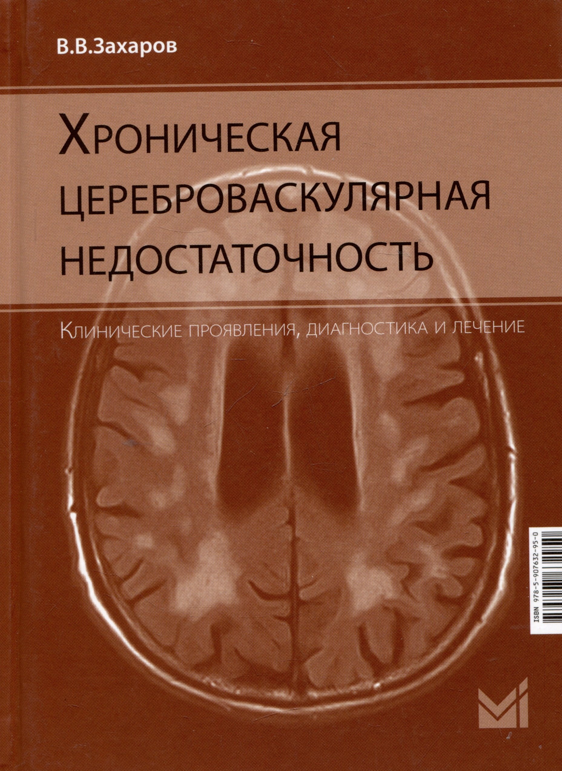 

Хроническая цереброваскулярная недостаточность