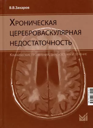 Хроническая цереброваскулярная недостаточность — 3044805 — 1