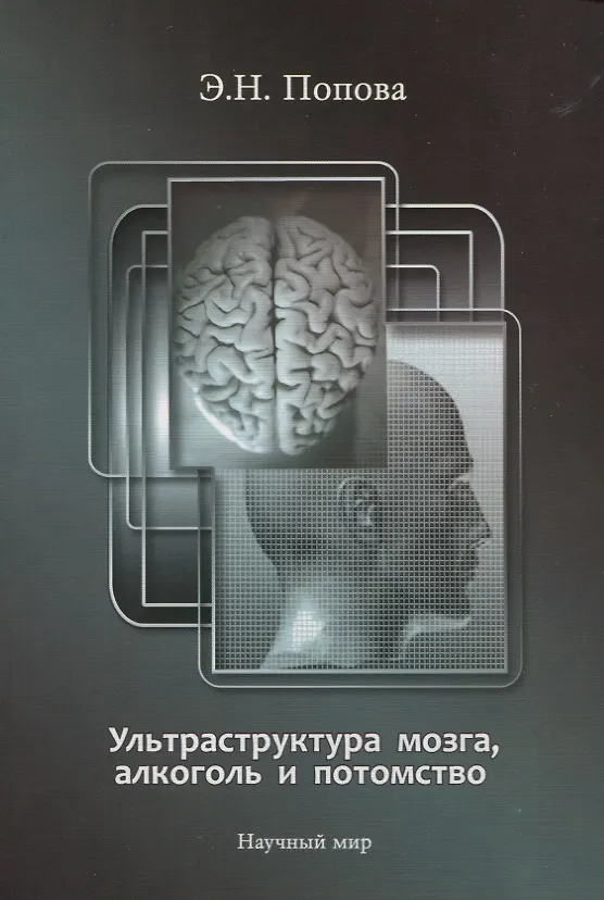 Книга Ультраструктура мозга, алкоголь и потомство () — 1