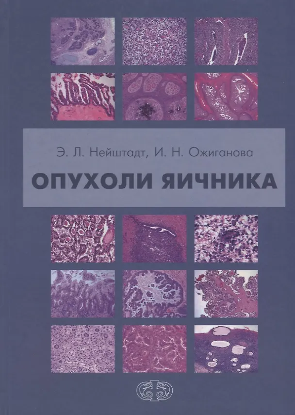 Книга Опухоли яичника () — 1