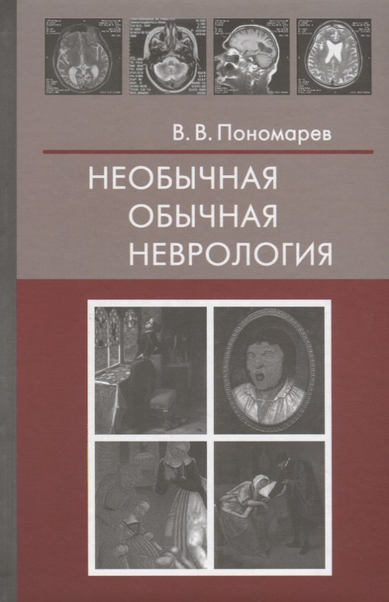 

Необычная обычная неврология (Пономарев)