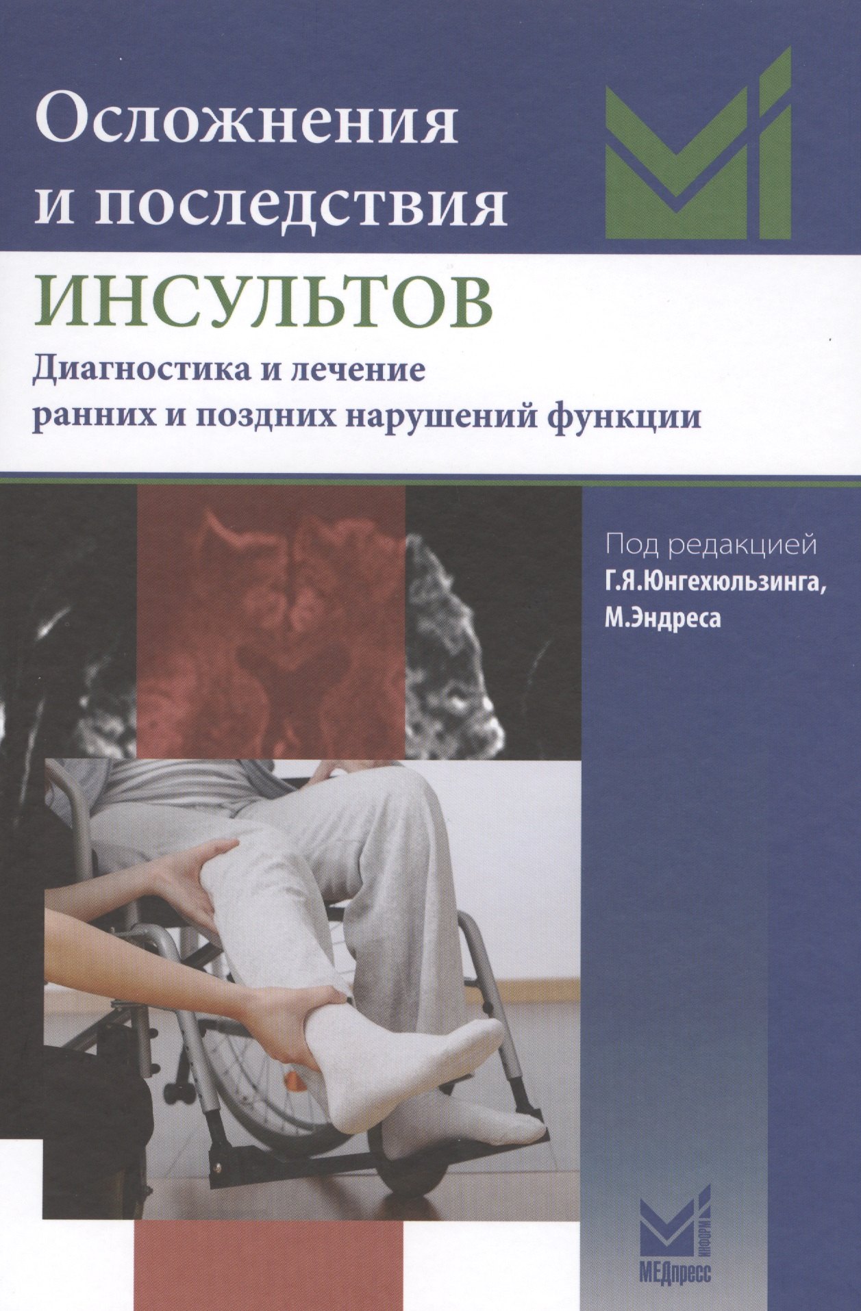 

Осложнения и последствия инсультов
