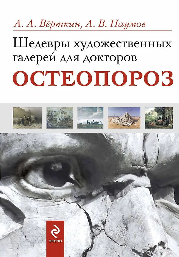 Книга Шедевры художественных галерей для докторов. Остеопороз (Аркадий Вёрткин) — 1