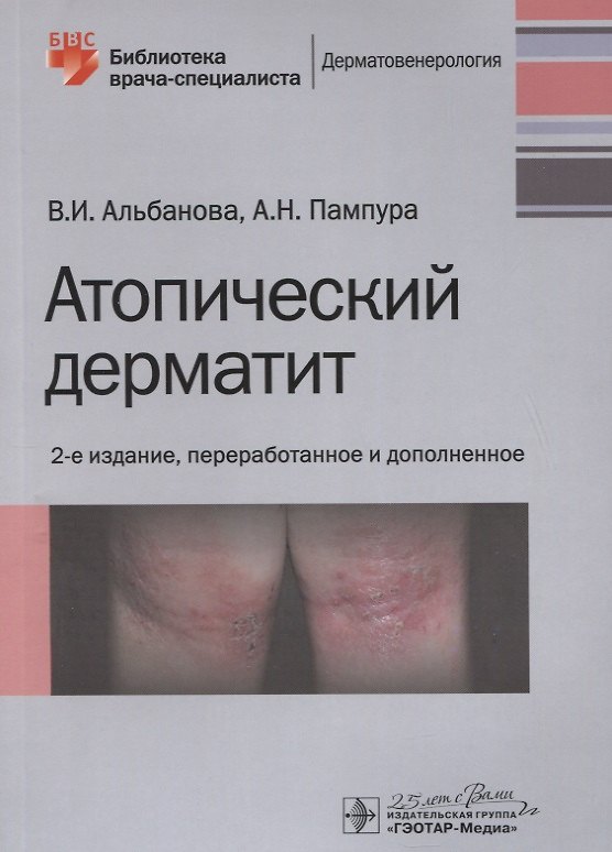 Книга Атопический дерматит (Вера Альбанова) — 1