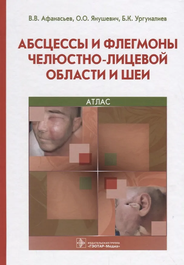 Книга Абсцессы и флегмоны челюстно-лицевой области и шеи 18-19г. (Василий Афанасьев) — 1