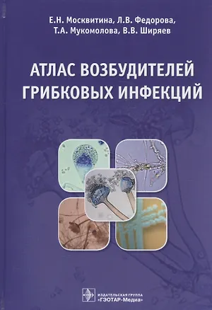 Книга Атлас возбудителей грибковых инфекций (Москвитина) ()