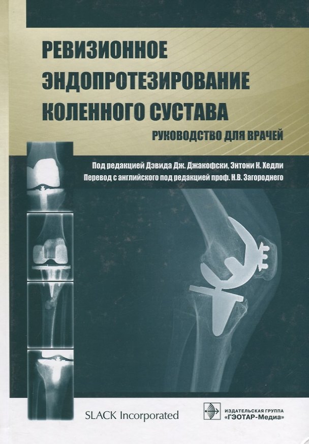 Книга Ревизионное эндопротезирование коленного сустава : руководство для врачей () — 1