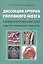 Диссекция артерий головного мозга. Ишемический инсульт и другие клинические проявления — 2497369 — 1