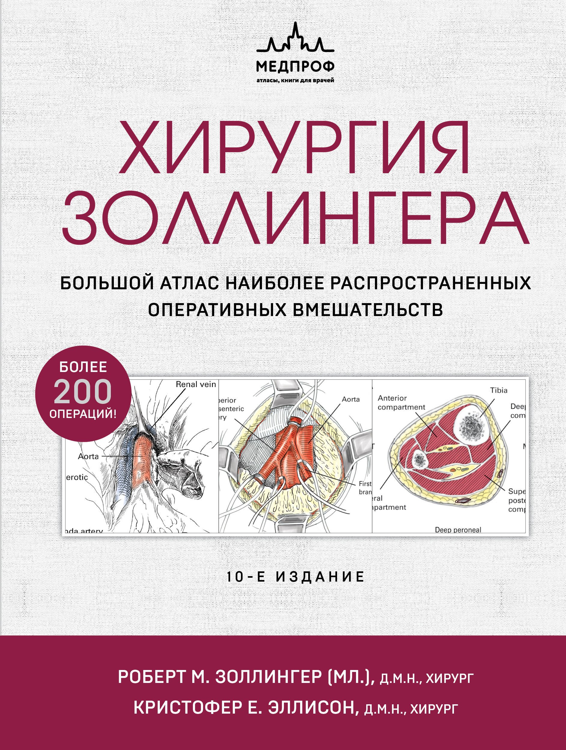 

Хирургия Золлингера. Большой атлас наиболее распространенных оперативных вмешательств