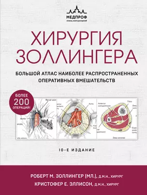 Хирургия Золлингера. Большой атлас наиболее распространенных оперативных вмешательств — 2963884 — 1