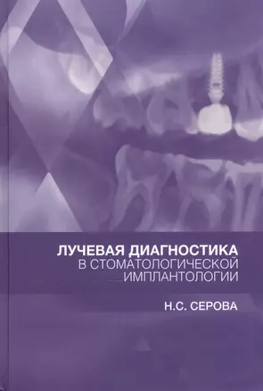 Лучевая диагностика в стоматологической имплантологии — 2528097 — 1