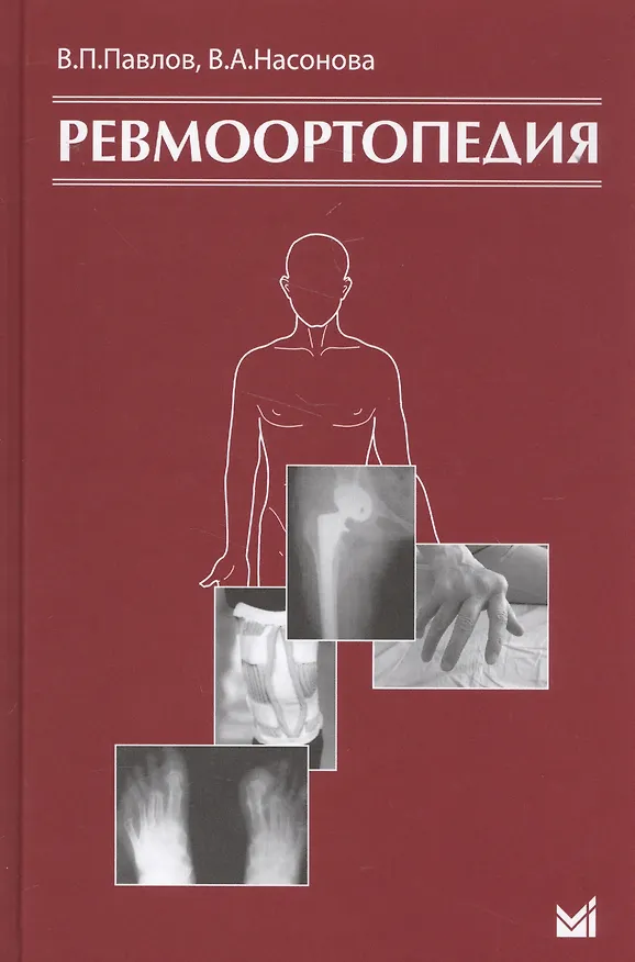 Книга Ревмоортопедия. 3-е издание (Валентина Насонова, Вадим Павлов) — 1