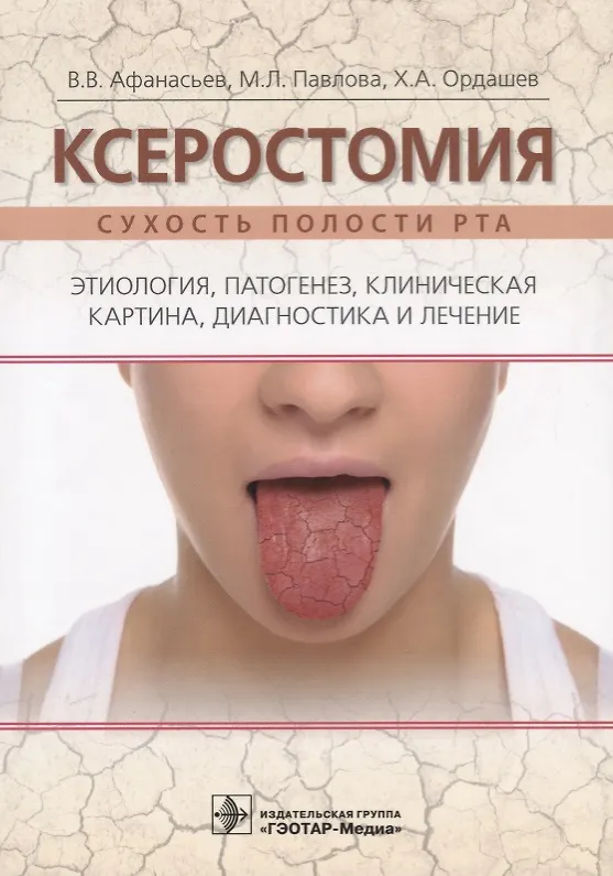 Книга Ксеростомия. Сухость полости рта. Этиология, патогенез, клиническая картина, диагностика и лечение (Василий Афанасьев) — 1