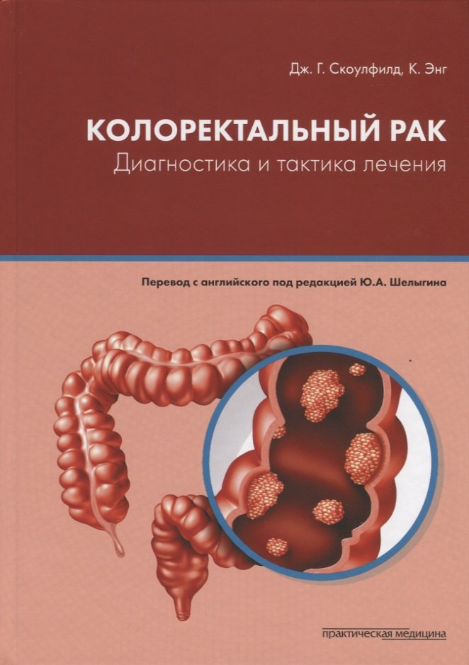 

Колоректальный рак. Диагностика и тактика лечения