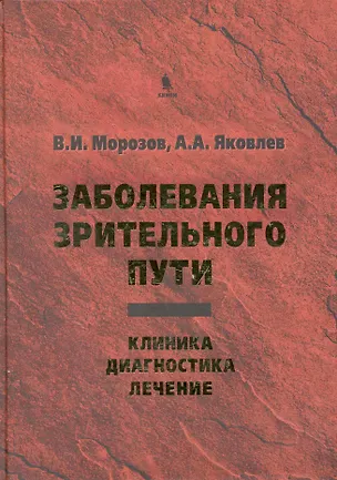 Книга Заболевания зрительного пути: Клиника. Диагностика. Лечение. ()