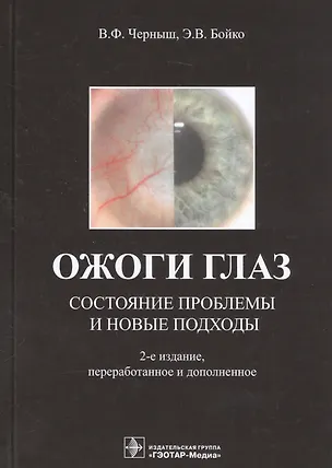 Книга Ожоги глаз. Состояние проблемы и новые подходы ()