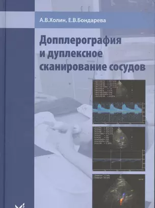 Допплерография и дуплексное сканирование сосудов — 2532270 — 1