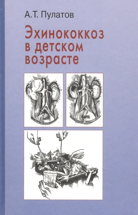 Книга Эхинококкоз в детском возрасте () — 1