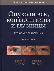 Опухоли век, конъюктивы и глазницы. Атлас и справочник. Том 1