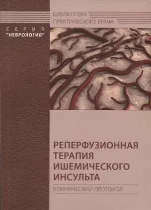 Реперфузионная терапия ишемического инсульта. Клинический протокол — 2742004 — 1