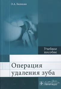 Операция удаления зуба.