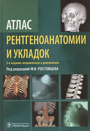 Книга Атлас рентгеноанатомии и укладок : руководство для врачей (Михаил Ростовцев)