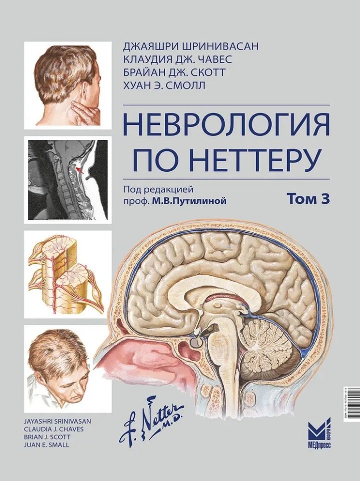 

Неврология по Неттеру: В 3-х томах. Том 3