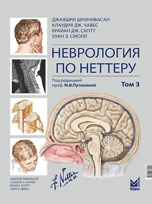 Книга Неврология по Неттеру: В 3-х томах. Том 3 (Брайан Дж. Скотт, Клаудия Дж. Чавес, Джаярши Шринивасан)