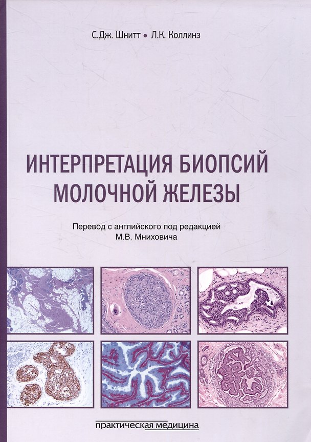 Книга Интерпретация биопсий молочной железы (Л.К. Коллинз, С.Дж. Шнитт) — 1