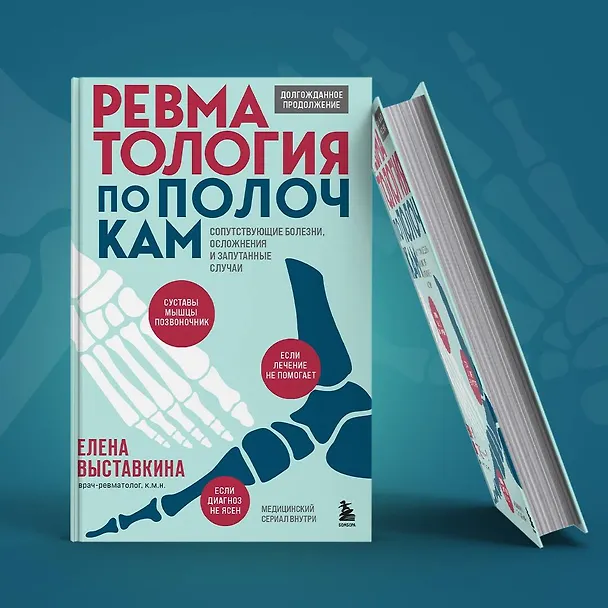 Книга Ревматология по полочкам. Сопутствующие болезни, осложнения и запутанные случаи (Елена Выставкина) — 12