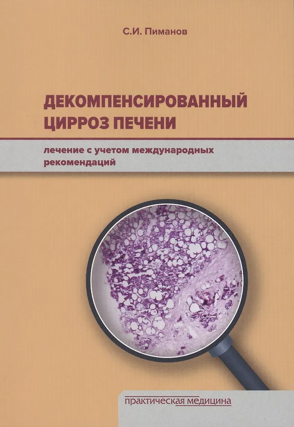 Книга Декомпенсированный цирроз печени: лечение с учетом международных рекомендаций. (Сергей Пиманов) — 1
