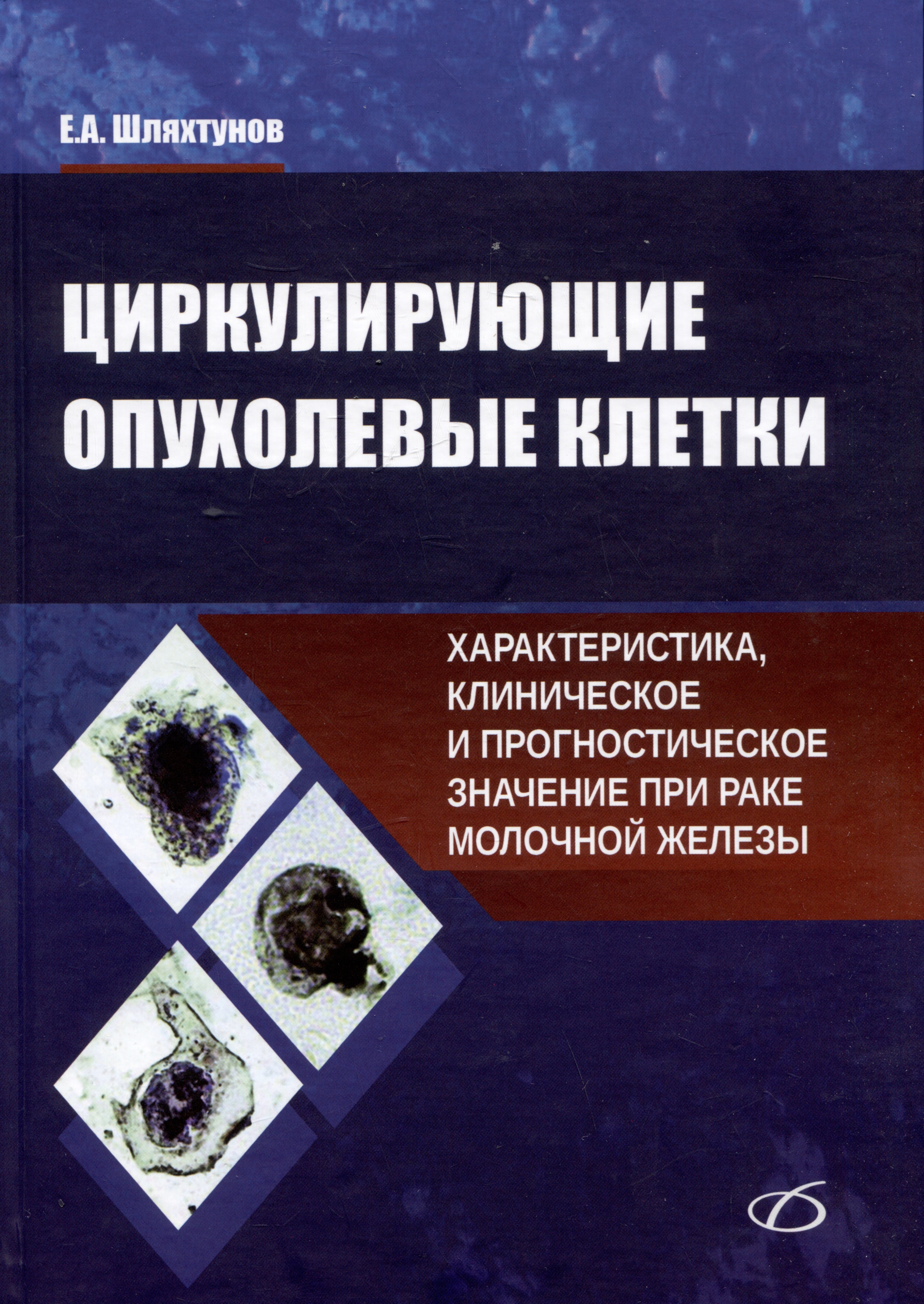 

Циркулирующие опухолевые клетки: характеристика, клиническое и прогностическое значение при раке молочной железы