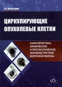 Циркулирующие опухолевые клетки: характеристика, клиническое и прогностическое значение при раке молочной железы