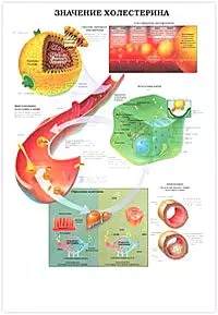 Плакат (70х108) Диабет/ Значение холестерина(А) — 2142111 — 1