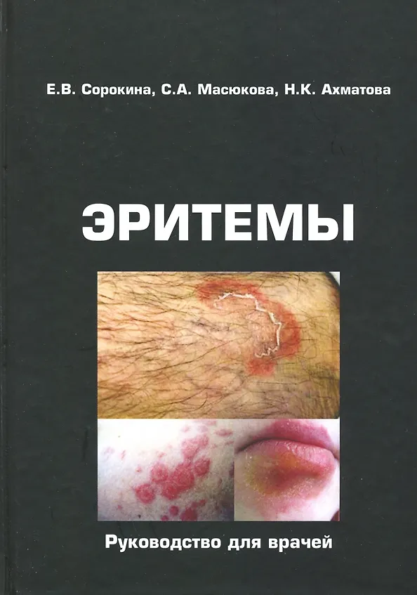 Книга Эритемы. Руководство для врачей (Е. Сорокина) — 1