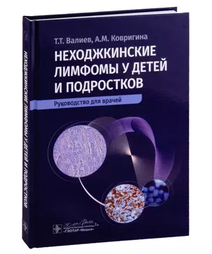 Неходжкинские лимфомы у детей и подростков: руководство для врачей — 3011834 — 1