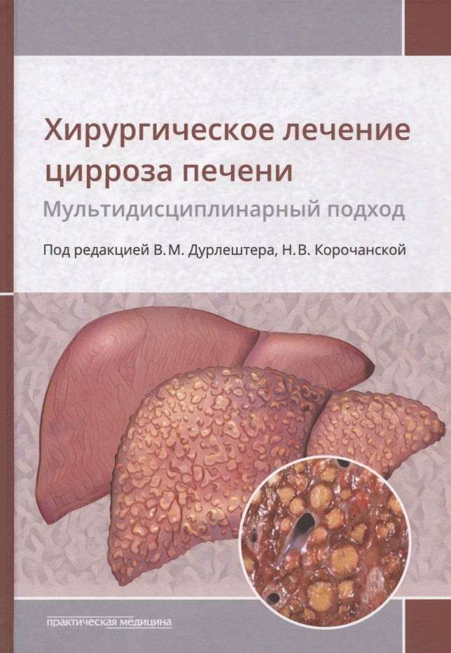 

Хирургическое лечение цирроза печени. Мультидисциплинарный подход. Монография