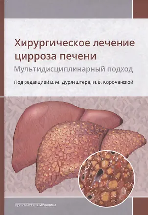 Книга Хирургическое лечение цирроза печени. Мультидисциплинарный подход. Монография ()