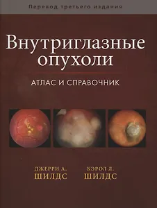 Внутриглазные опухоли. Атлас и справочник