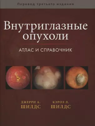 Внутриглазные опухоли. Атлас и справочник — 2668612 — 1