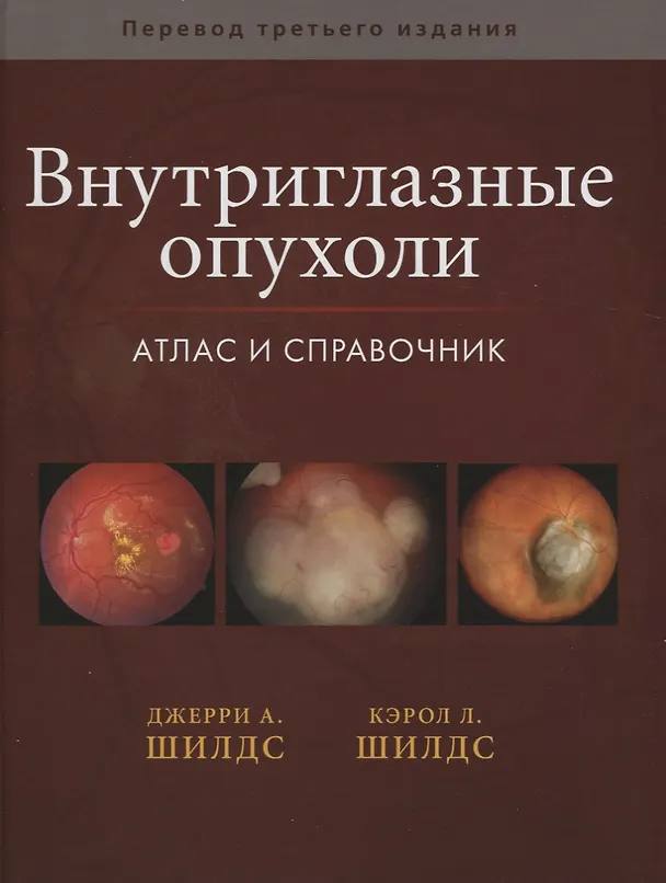 Книга Внутриглазные опухоли. Атлас и справочник () — 1
